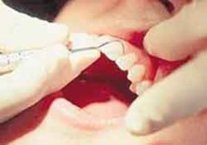 Diş Gıcırtdatma Önemsenmeli