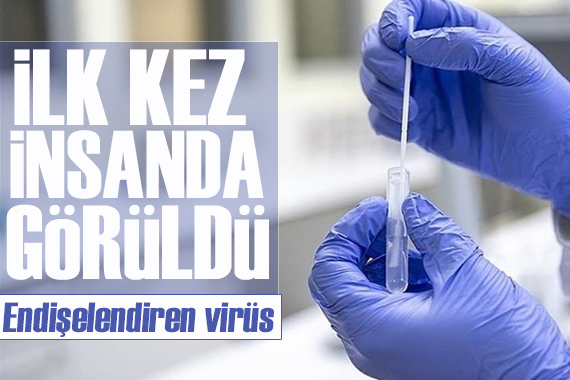 Endişelendiren virüs: İlk kez bir insanda görüldü