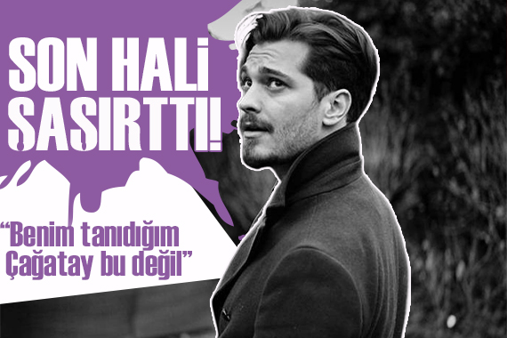 Çağatay Ulusoy son hali ile şaşırttı!