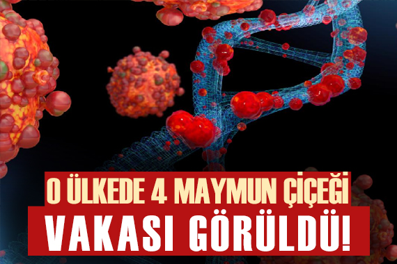 Tayvan da 4 yeni Maymun çiçeği vakası görüldü