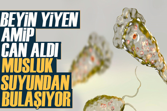 Musluk suyundan bulaşıyor: Beyin yiyen amip can aldı