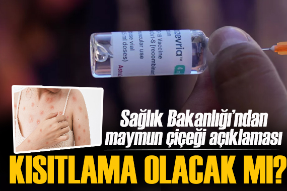 Son dakika / Sağlık Bakanlığı ndan maymun çiçeği açıklaması