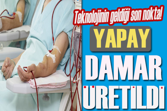 Teknolojinin geldiği son nokta! Yapay damar üretildi