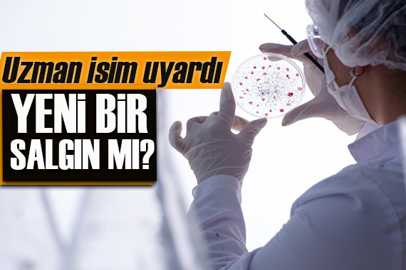 DSÖ açıkladı: Maymun çiçeği yeni bir salgına dönüşür mü?