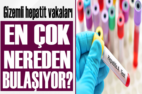 Gizemli hepatit vakaları için korkutan iddia!