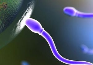 Yavaş Yüzen Sperm Sendromu