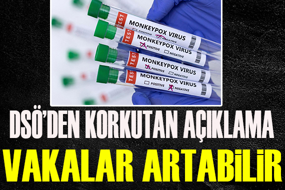 DSÖ den korkutan maymun çiçeği açıklaması: Vakalar artabilir