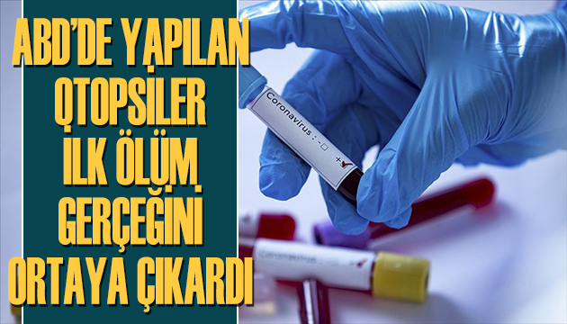 ABD de yapılan otopsiler ilk ölüm gerçeğini ortaya koydu!