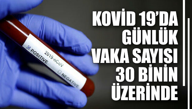 Bakan Koca, Kovid 19 da son durumu açıkladı