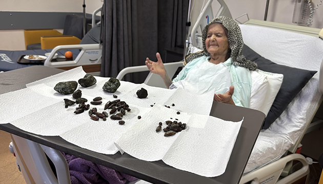 Yuttuğu zeytin ve hurma çekirdekleri nedeniyle ameliyat edildi