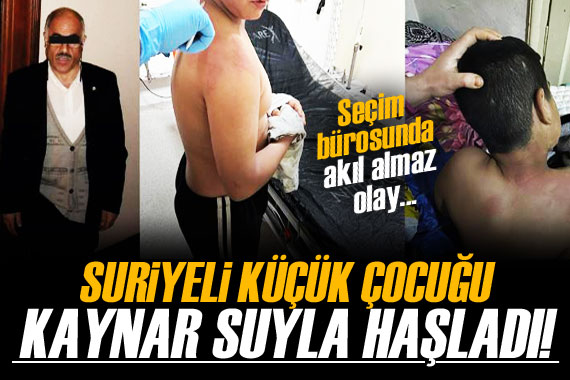 Suriyeli çocuğu kaynar suyla haşladı!