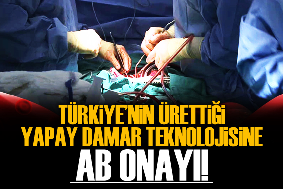 Türkiye’nin ürettiği yapay damar teknolojisine AB onayı