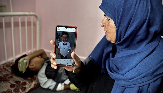 Gözünde tümor bulunan Gazzeli Muhammed tedavi olmayı bekliyor