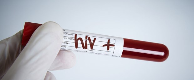 Tüm hamilelere HIV taraması yapılacak