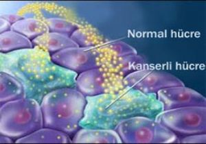 Nano Teknoloji Kanserde Mucize Yaratıyor