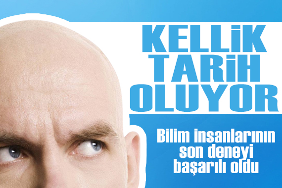 Kellik tarih oluyor! Bilim insanlarından umut veren deney