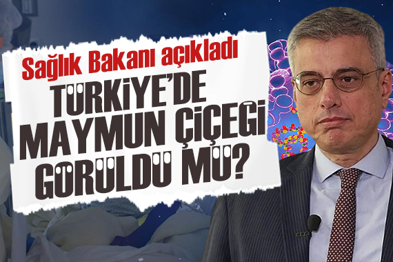 Türkiye de  Maymun çiçeği  görüldü mü? Sağlık Bakanı Memişoğlu ndan açıklama