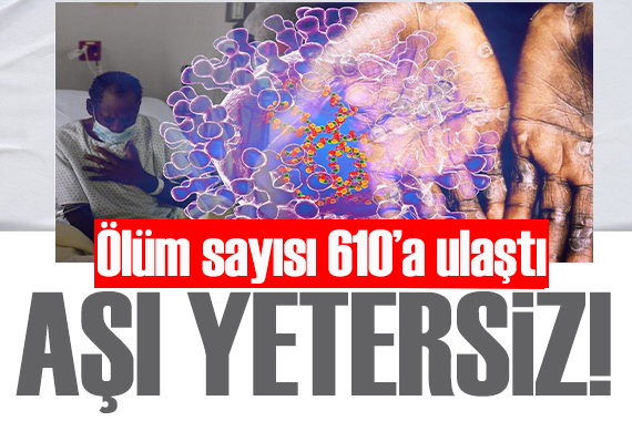  Maymun çiçeğinde aşı yetersiz : Ölenlerin sayısı 610 a yükseldi