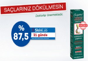 Saç Dökülmesini Zigavus Sarımsaklı Şampuan ile Durdurun